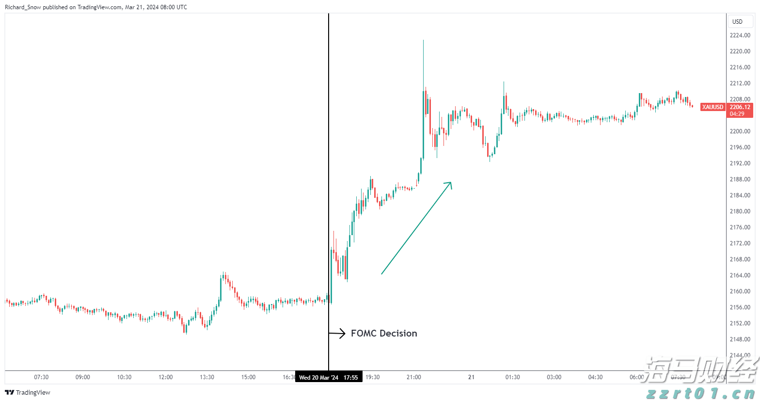 甲状腺外科成功实施高难度局部晚期甲状腺癌扩大根治手术
